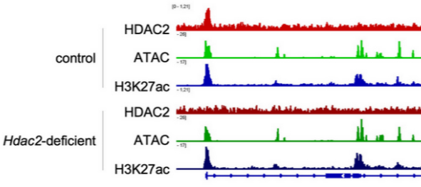 HDAC2 in PDAC