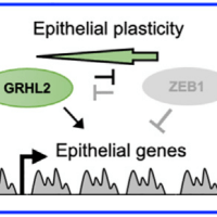 Unveiling EMT Resistance in Metastatic Breast&nbsp;Cancer